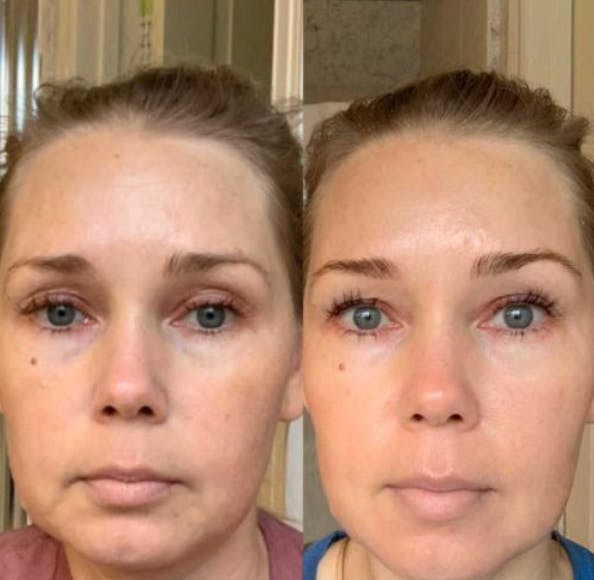 Glass Skin Collagen Mask photo review